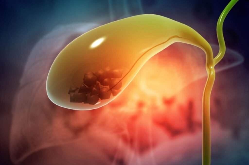 য়াম্না তাঙনা থোকপা কেস অমা ওইনা নূপী অমগী গোল্ ব্লাদরদগী সেন্টিমিটর ৯ শাংবা নূঙ অমা মায় পাক্না লৌথোকপা ঙমখ্রে